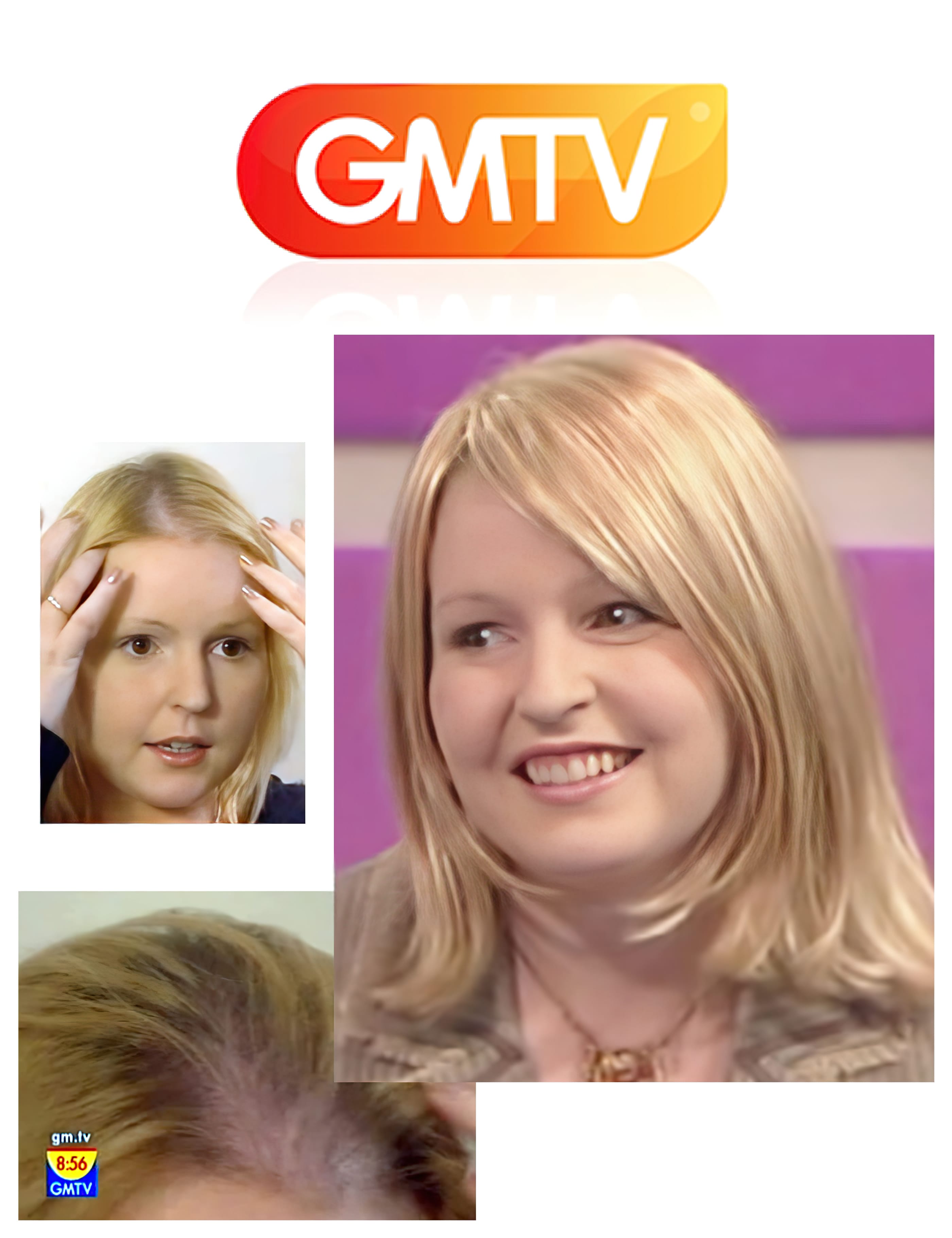 GMTV Live Miracle Makeover for female hair loss - Mark Glenn
