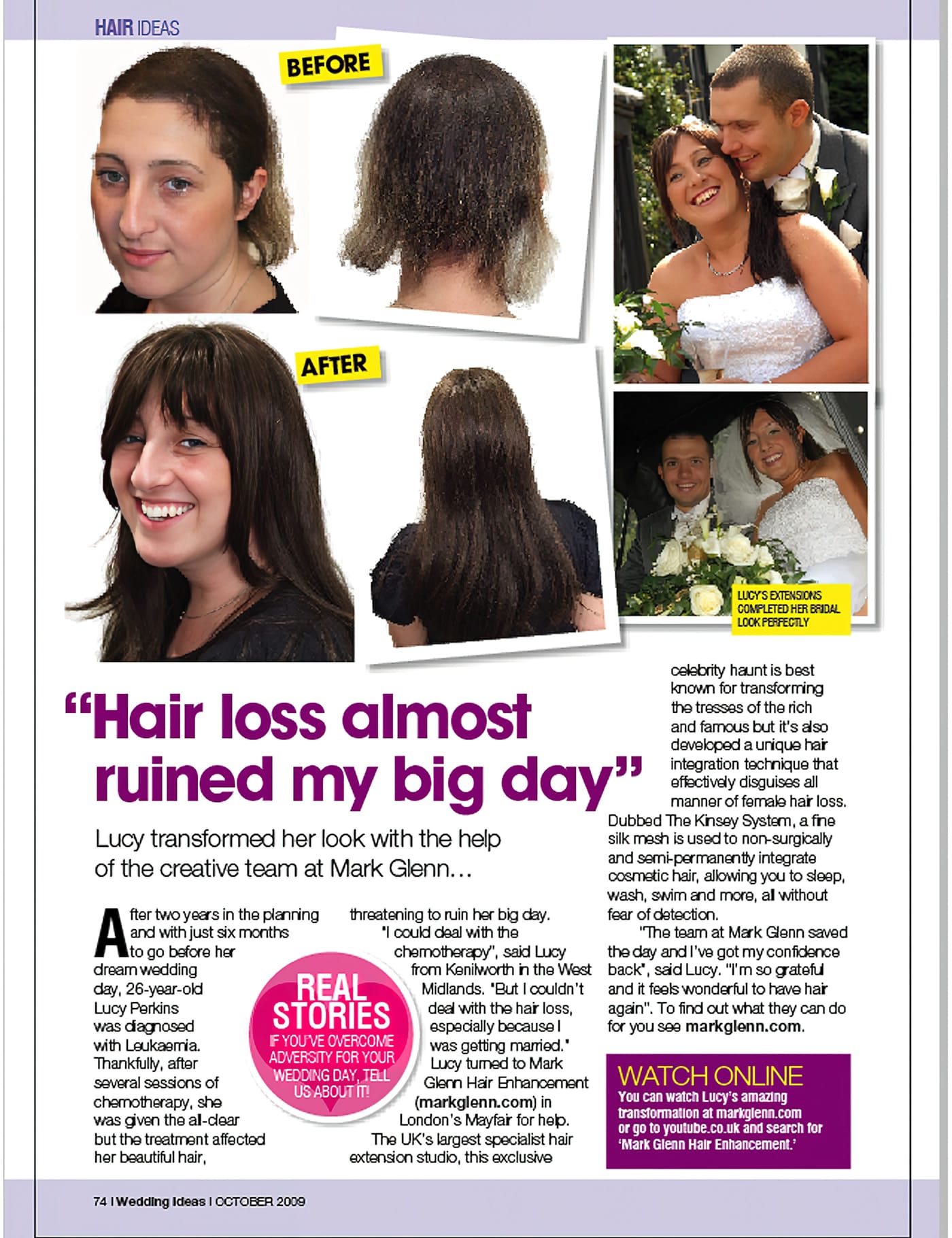 HL103-M - Leukaemia Hair Loss Restored for Wedding - Kinsey System, London  | Case Study