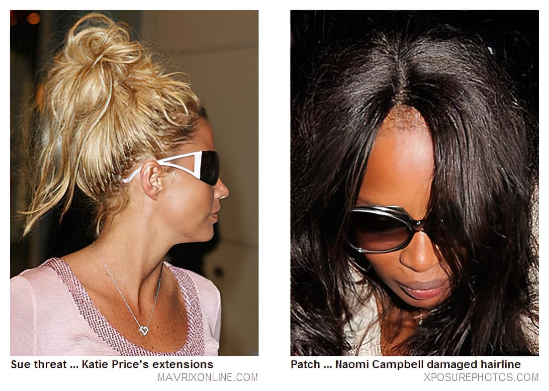 Sue threat... Katie Price's extensions | Patch... Naomi Campblell damaged hairline