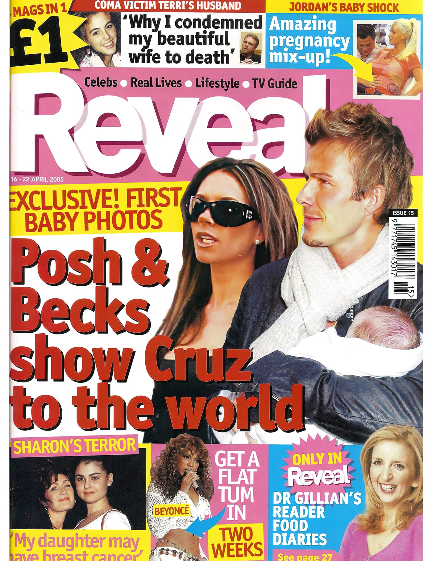 'I made myself bald and found love' - Mark Glenn's Trichotillomania solution: Reveal Magazine